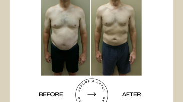 Beige Minimalist Before and After Skincare Transformation Instagram Post (11)