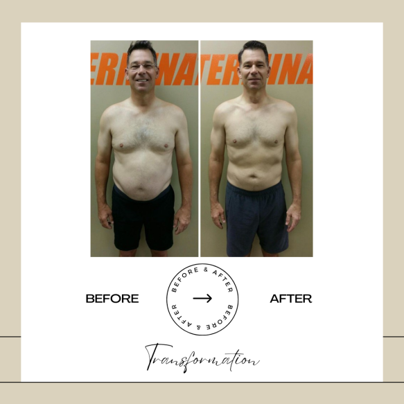 Beige Minimalist Before and After Skincare Transformation Instagram Post (11)