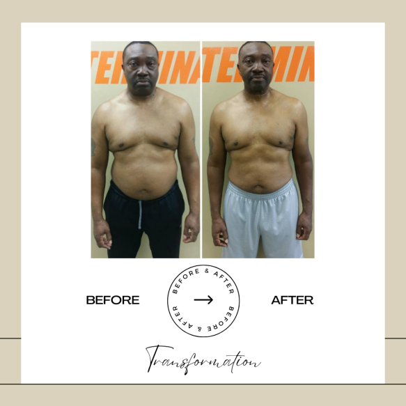 Beige Minimalist Before and After Skincare Transformation Instagram Post (6)