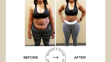 Beige Minimalist Before and After Skincare Transformation Instagram Post (9)