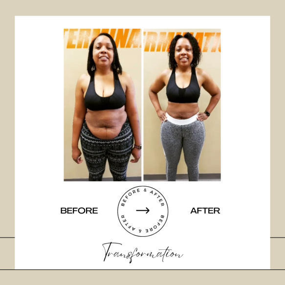 Beige Minimalist Before and After Skincare Transformation Instagram Post (9)