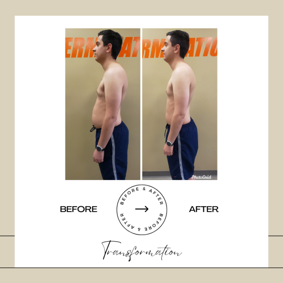 Beige Minimalist Before and After Skincare Transformation Instagram Post (35)