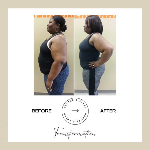 Beige Minimalist Before and After Skincare Transformation Instagram Post (41)
