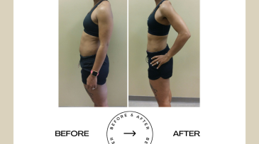 Beige Minimalist Before and After Skincare Transformation Instagram Post (42)