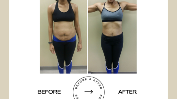 Beige Minimalist Before and After Skincare Transformation Instagram Post (44)