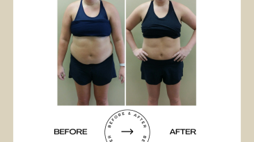Beige Minimalist Before and After Skincare Transformation Instagram Post (45)
