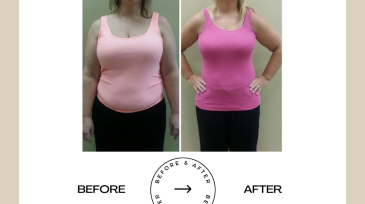 Beige Minimalist Before and After Skincare Transformation Instagram Post (46)