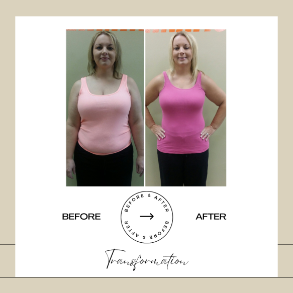 Beige Minimalist Before and After Skincare Transformation Instagram Post (46)
