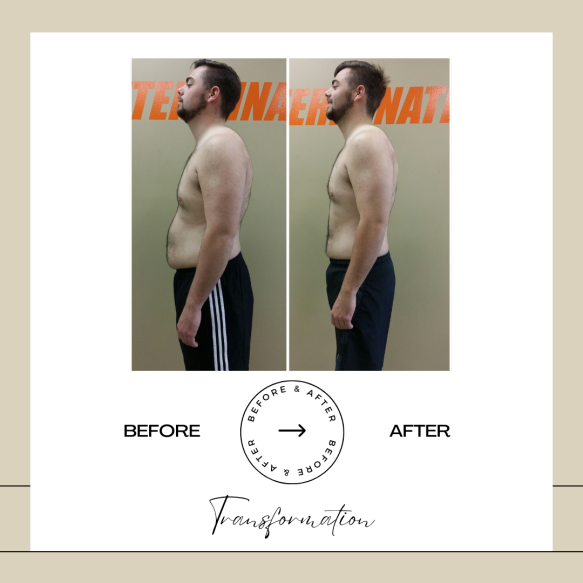 Beige Minimalist Before and After Skincare Transformation Instagram Post (49)