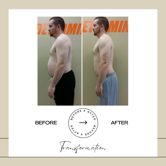 Beige Minimalist Before and After Skincare Transformation Instagram Post (51)