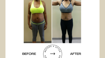 Beige Minimalist Before and After Skincare Transformation Instagram Post (52)