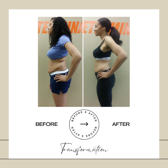 Beige Minimalist Before and After Skincare Transformation Instagram Post (53)