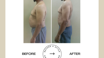 Beige Minimalist Before and After Skincare Transformation Instagram Post (55)