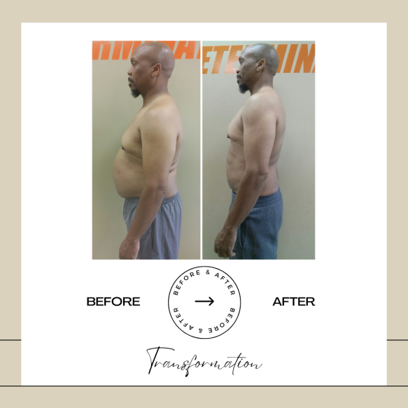 Beige Minimalist Before and After Skincare Transformation Instagram Post (55)