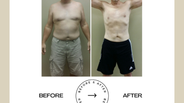 Beige Minimalist Before and After Skincare Transformation Instagram Post (58)