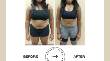 Beige Minimalist Before and After Skincare Transformation Instagram Post (59)