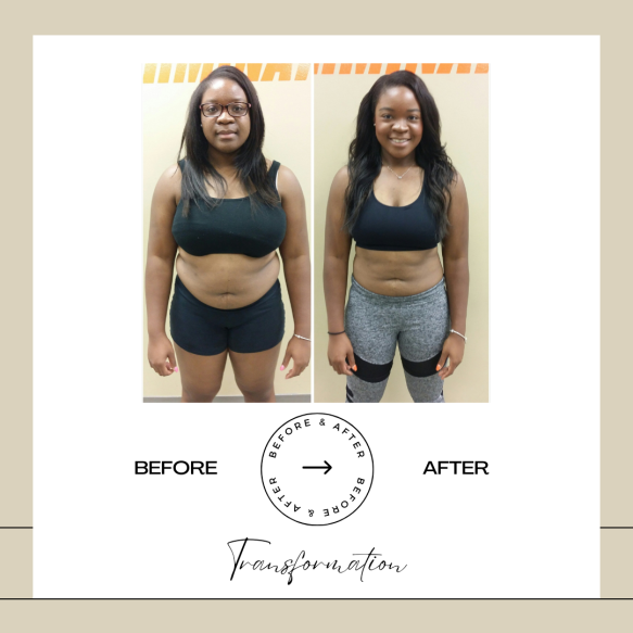 Beige Minimalist Before and After Skincare Transformation Instagram Post (59)