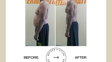 Beige Minimalist Before and After Skincare Transformation Instagram Post (60)